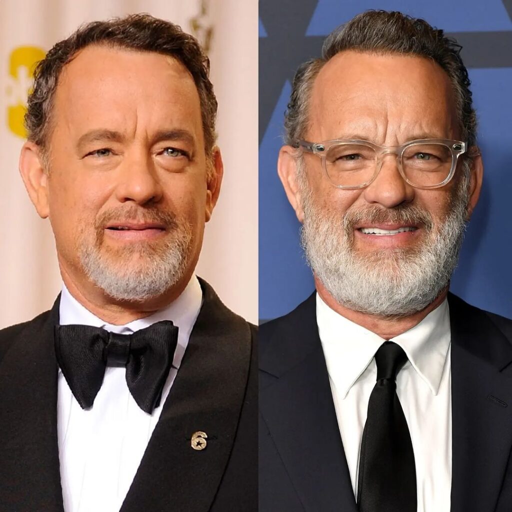 Tom Hanks Plastic Surgery Photos [Before & After] - Surgery4