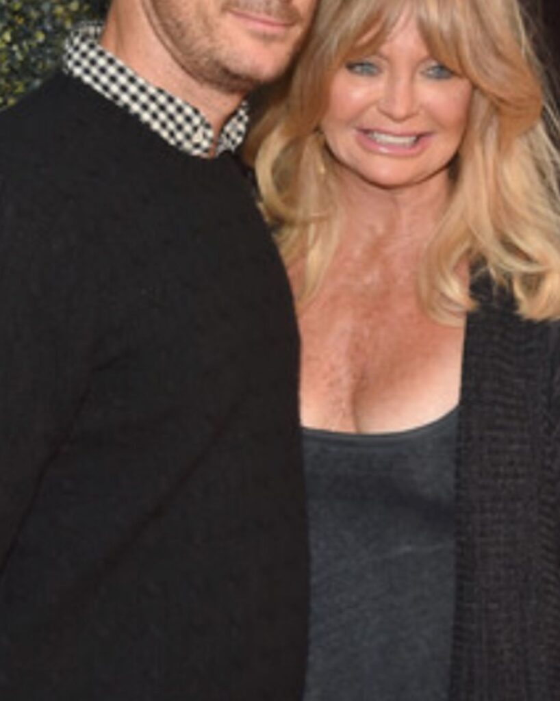 Goldie Hawn Plastic Surgery (2)