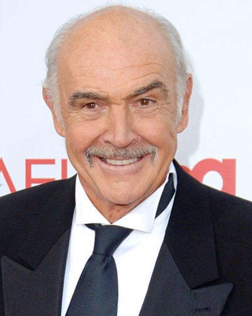 Sean Connery Plastic Surgery (3)