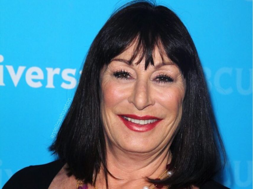 Anjelica Huston Plastic Surgery (3)