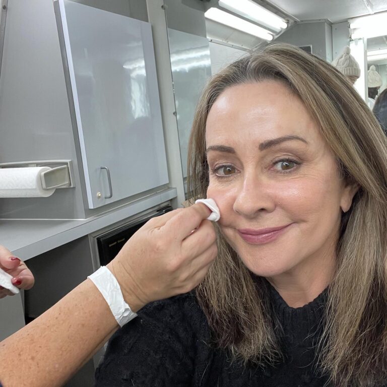 Patricia Heaton Plastic Surgery Photos Before After Surgery4