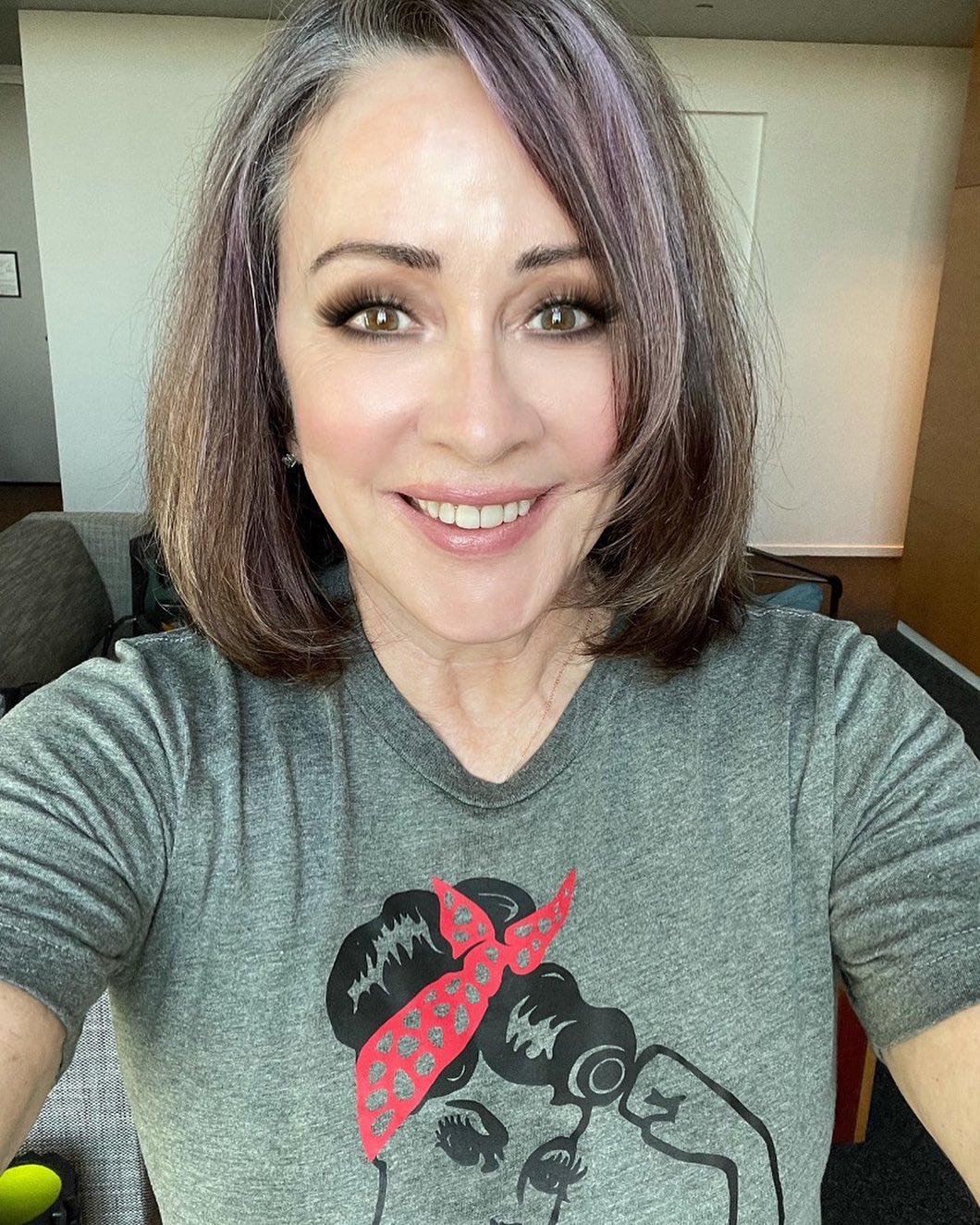 Patricia Heaton Plastic Surgery Photos Before After Surgery