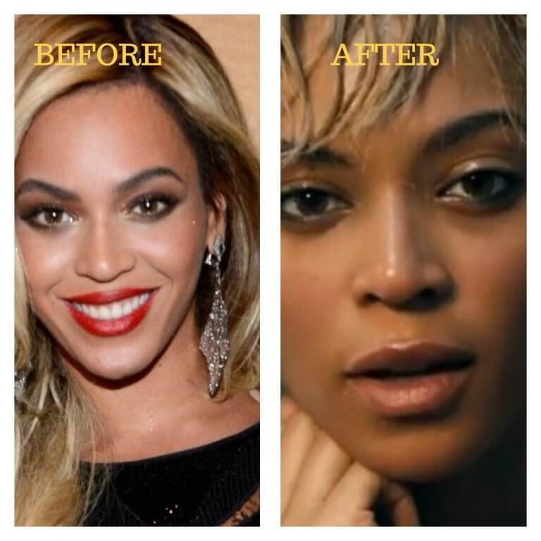 Beyonce Nose Job Photos [before And After] Surgery4