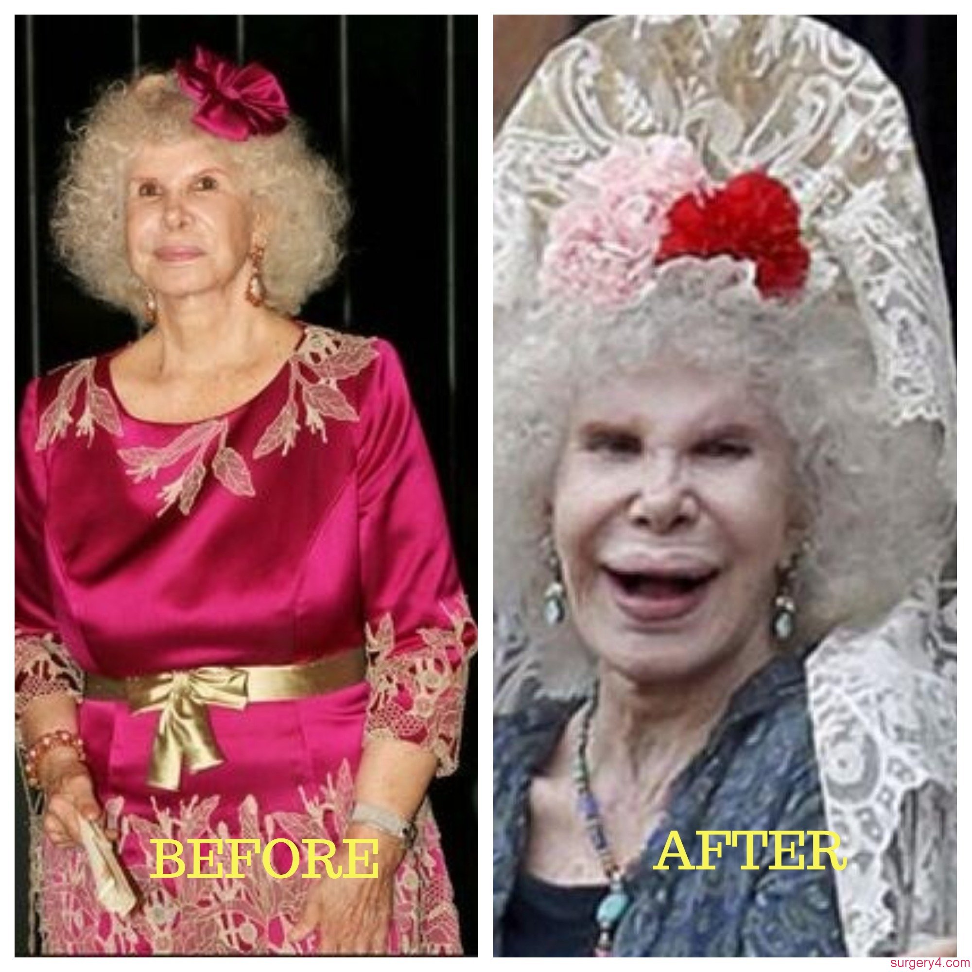 Duchess of Alba Plastic Surgery Photos [Before & After] - Surgery4.