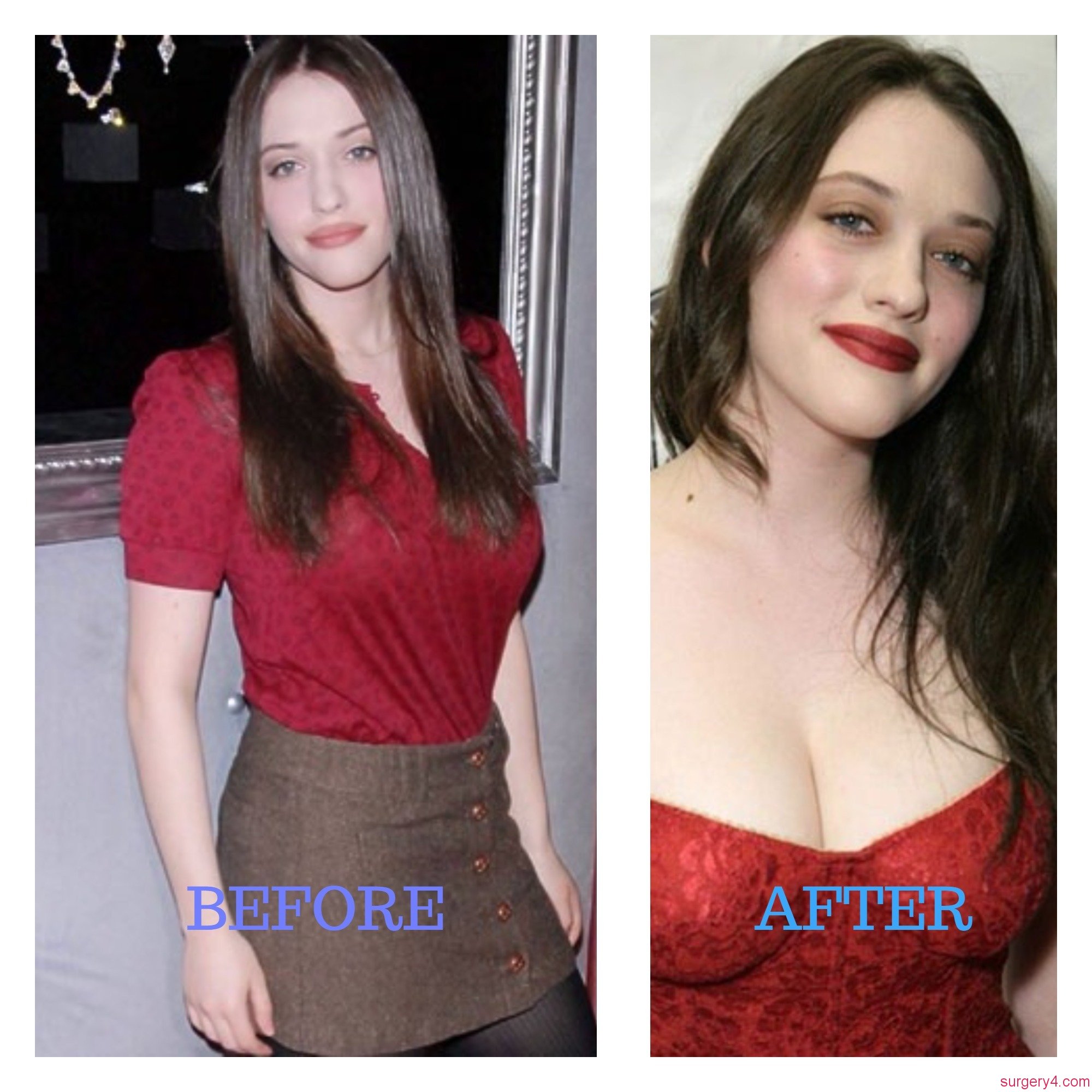 Kat Dennings Plastic Surgery Photos [Before & After] - Surgery4.