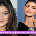 Kylie Jenner Plastic Surgery