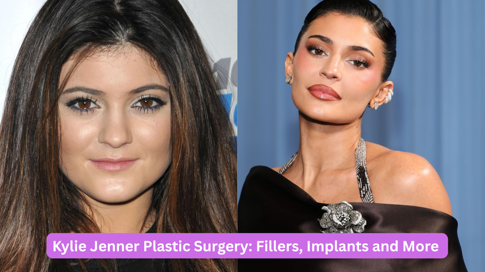 Kylie Jenner Plastic Surgery
