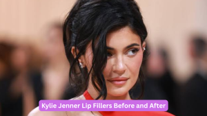 Kylie Jenner Plastic Surgery