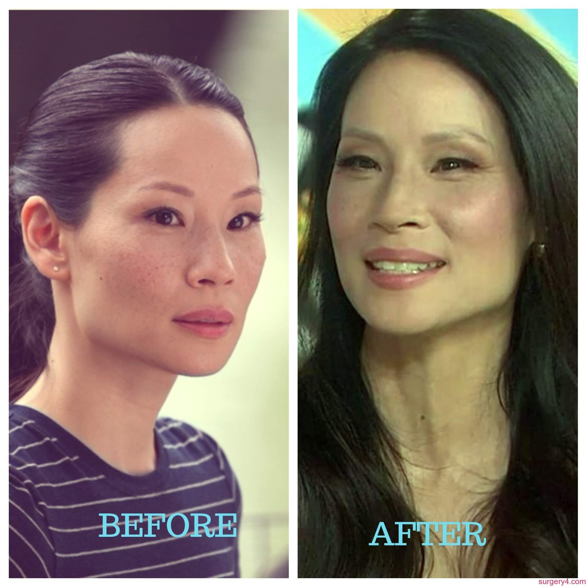 Lucy Liu Plastic Surgery Photos [Before & After] ⋆ Surgery4