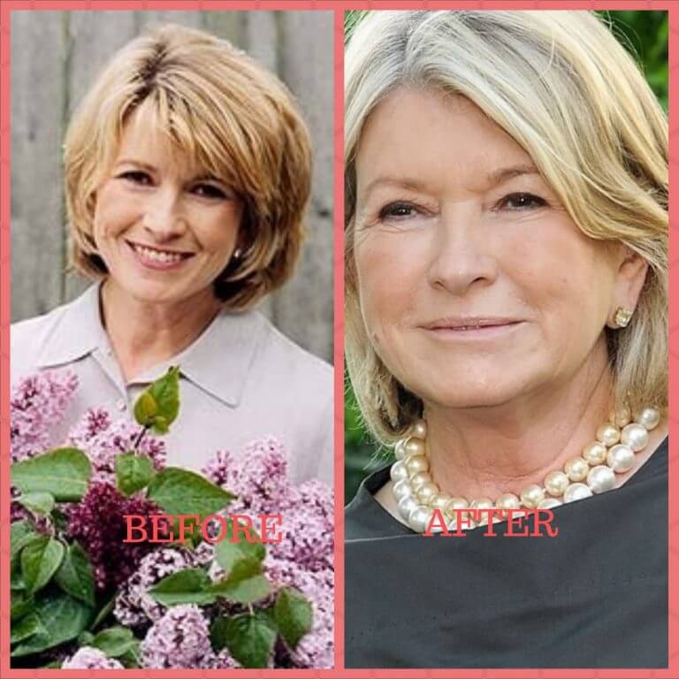 Martha Stewart Plastic Surgery Photos [before And After] Surgery4
