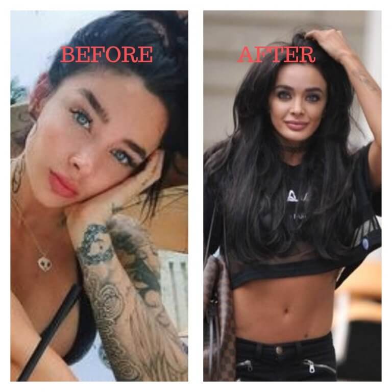 Joan Kennedy Plastic Surgery Photos [Before & After] Surgery4