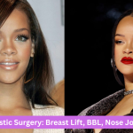 Rihanna Plastic Surgery