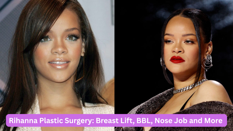 Rihanna Plastic Surgery
