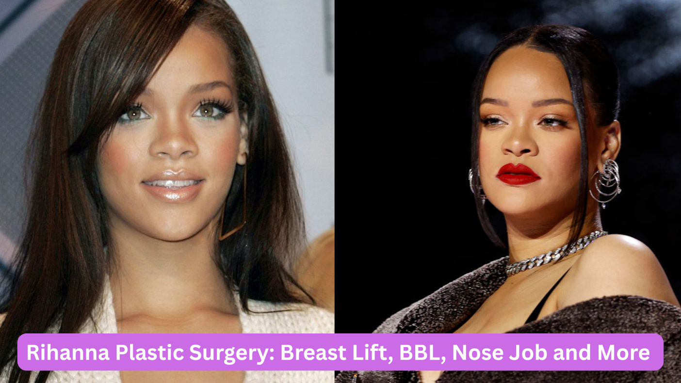 Rihanna Plastic Surgery