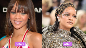 Rihanna Plastic Surgery Before and After: What Do the Photos Show