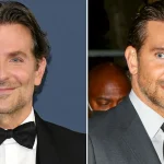 bradley cooper plastic surgery