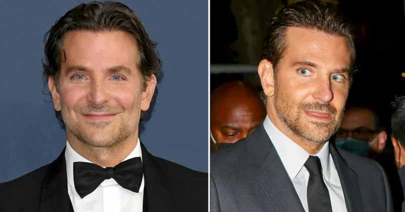 bradley cooper plastic surgery