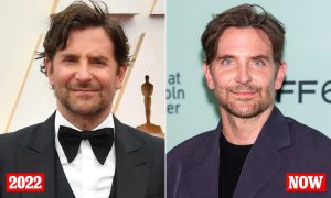 bradley cooper plastic surgery