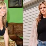 brandi passante plastic surgery