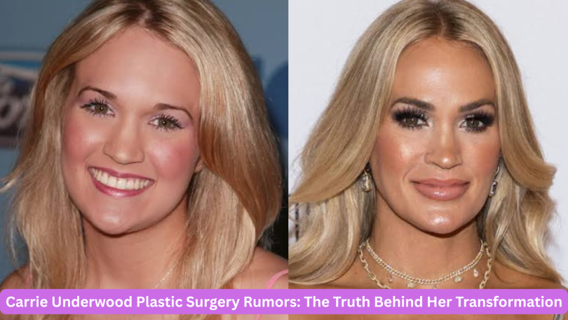 carrie underwood plastic surgery