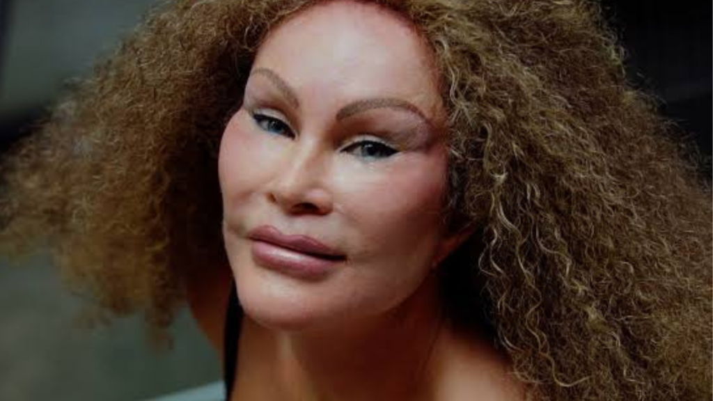 cat lady plastic surgery