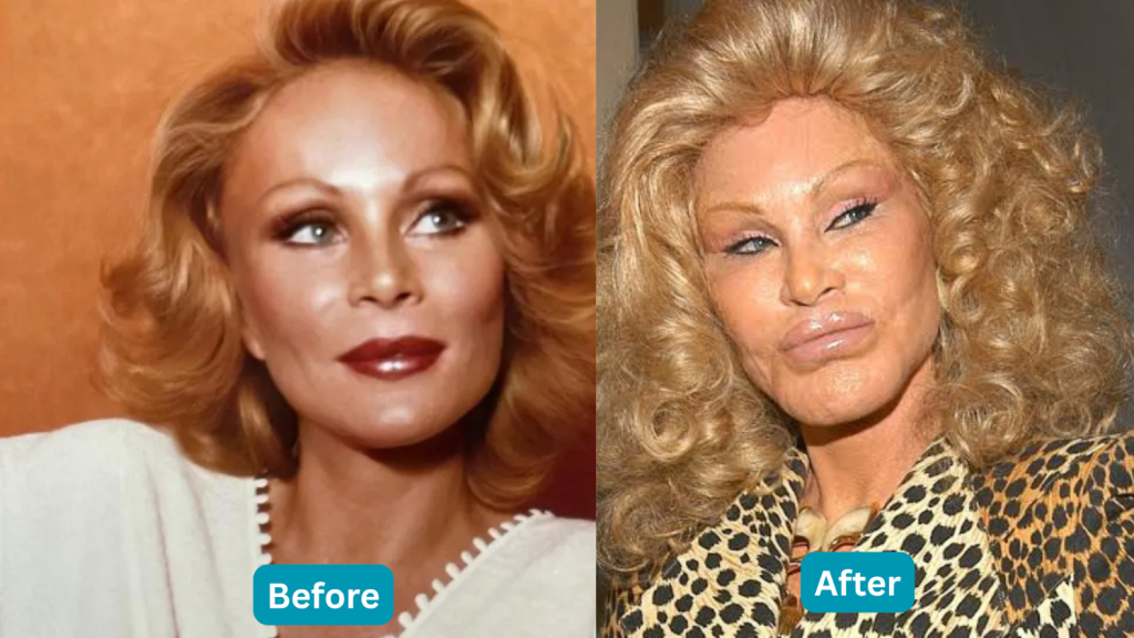 Cat Lady Before and After: What Can We Really Tell?