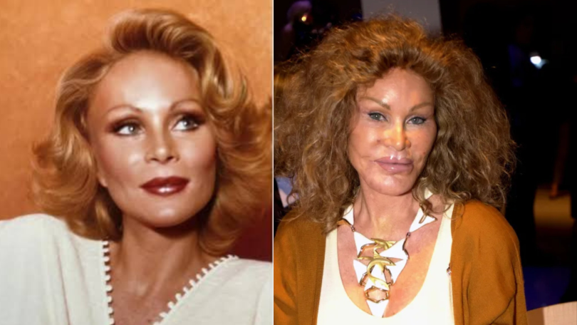 cat lady plastic surgery