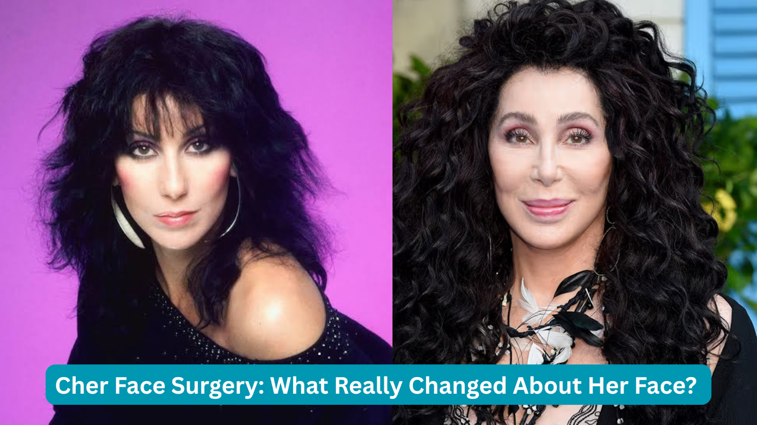 cher face surgery