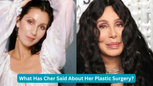cher face surgery