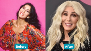 Cher Before and After: What Do the Photos Show?