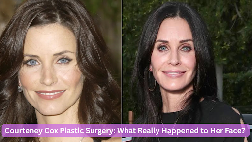 courteney cox plastic surgery