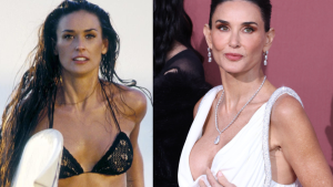 Breast Implants and Other Body Procedures