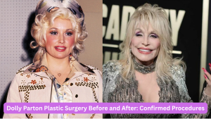dolly parton plastic surgery before and after 