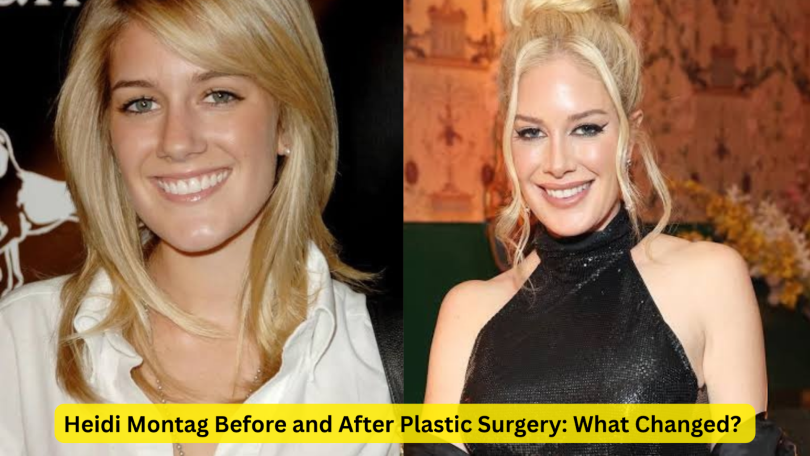 heidi montag before and after plastic surgery