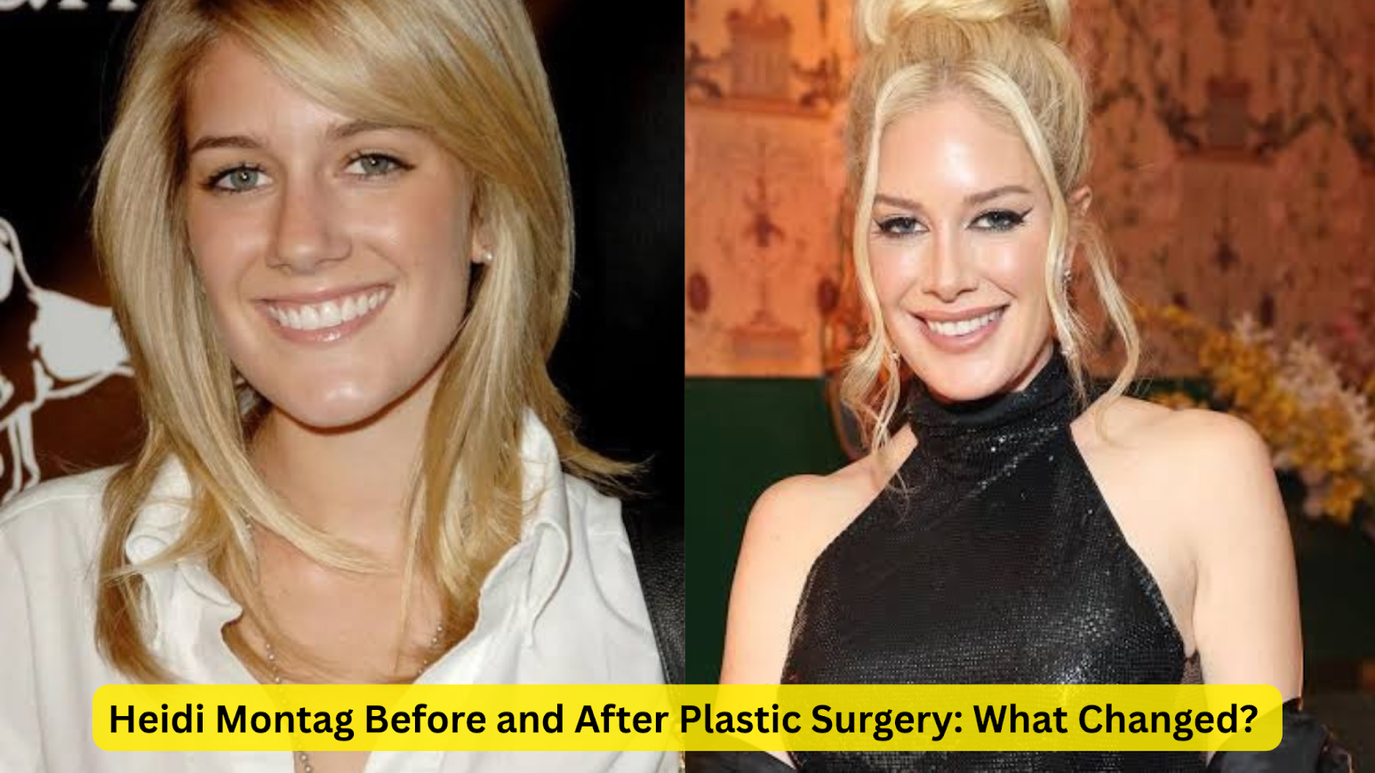 heidi montag before and after plastic surgery