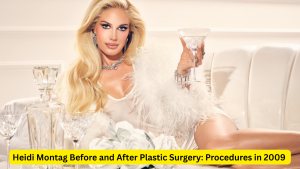 heidi montag before and after plastic surgery