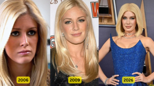 Heidi Montag Before and After Plastic Surgery
