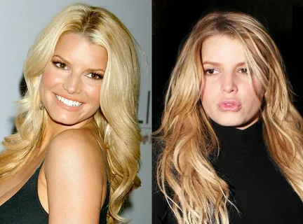 jessica simpson plastic surgery
