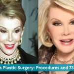 joan rivers plastic surgery