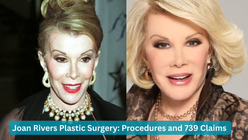 joan rivers plastic surgery