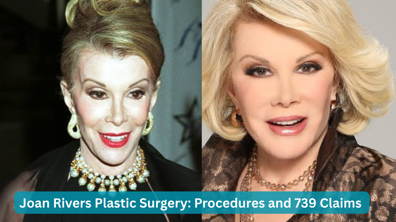 joan rivers plastic surgery