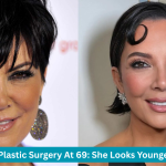 kris jenner plastic surgery