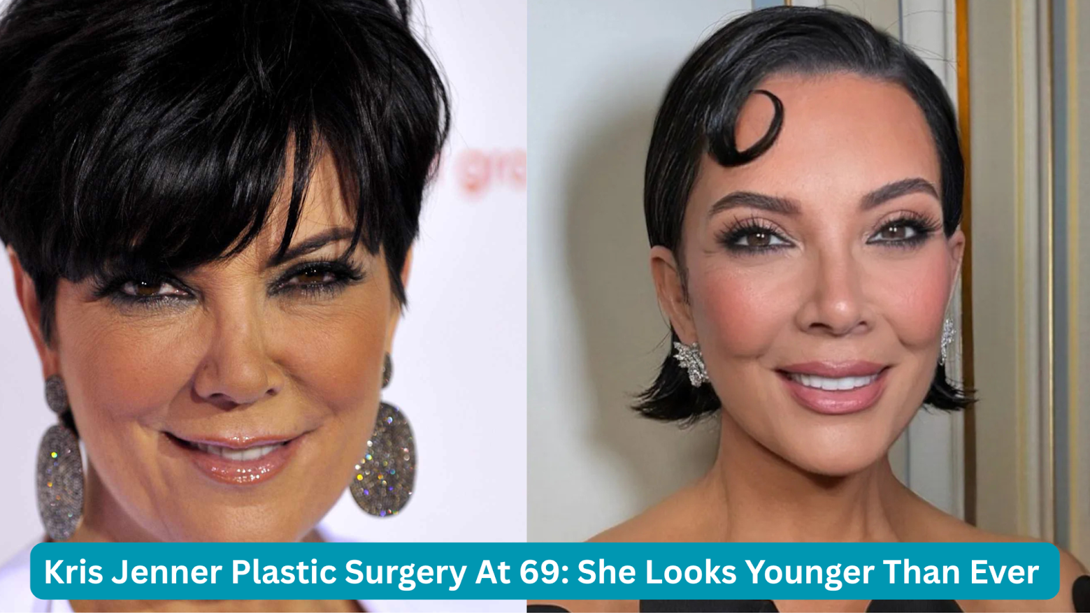 kris jenner plastic surgery