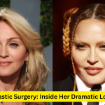 madonna plastic surgery