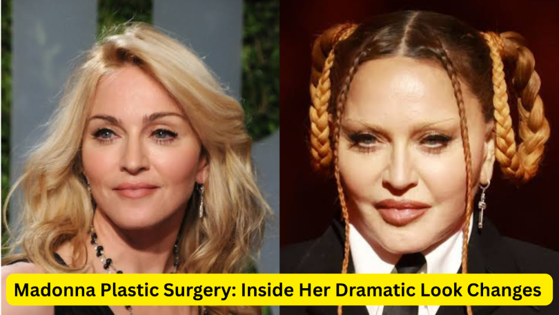 madonna plastic surgery