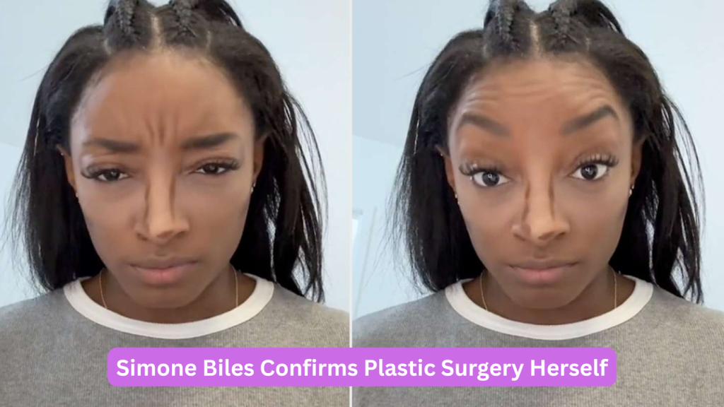 simone biles plastic surgery