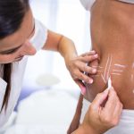 what is liposuction